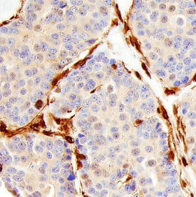 Immunohistochemistry Annexin A1 Antibody [Unconjugated]