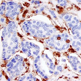 <b>Genetic Strategies Validation. </b>Annexin A1 was detected in immersion fixed paraffin-embedded sections of human breast using Mouse Anti-Human/Mouse Annexin A1 Monoclonal Antibody (Catalog # MAB3770) at 15 µg/mL overnight at 4 °C. Before incubation with the primary antibody, tissue was subjected to heat-induced epitope retrieval using Antigen Retrieval Reagent-Basic (Catalog # CTS013). Tissue was stained using the Anti-Mouse HRP-DAB Cell & Tissue Staining Kit (brown; Catalog # CTS002) and counterstained with hematoxylin (blue). Specific staining was localized to myoepithelial cells. View our protocol for Chromogenic IHC Staining of Paraffin-embedded Tissue Sections.