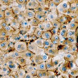 Annexin A2 was detected in immersion fixed paraffin-embedded sections of normal human liver using Goat Anti-Human/Mouse/Rat Annexin A2 Antigen Affinity-purified Polyclonal Antibody (Catalog # AF3928) at 3 µg/mL overnight at 4 °C. Before incubation with the primary antibody, tissue was subjected to heat-induced epitope retrieval using Antigen Retrieval Reagent-Basic (Catalog # CTS013). Tissue was stained using the Anti-Goat HRP-DAB Cell & Tissue Staining Kit (brown; Catalog # CTS008) and counterstained with hematoxylin (blue). Specific staining was localized to plasma membranes of hepatocytes. View our protocol for Chromogenic IHC Staining of Paraffin-embedded Tissue Sections.