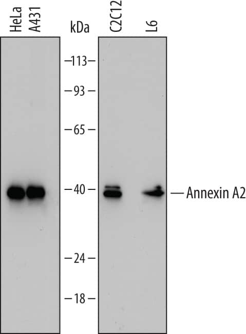 Western blot shows lysates of HeLa human cervical epithelial carcinoma cell line, A431 human epithelial carcinoma cell line, C2C12 mouse myoblast cell line, and L6 rat myoblast cell line. PVDF Membrane was probed with 0.1 µg/mL of Mouse Anti-Human/Mouse/Rat Annexin A2 Monoclonal Antibody (Catalog # MAB3928) followed by HRP-conjugated Anti-Mouse IgG Secondary Antibody (Catalog # HAF007). A specific band was detected for Annexin A2 at approximately 40 kDa (as indicated). This experiment was conducted under reducing conditions and using Immunoblot Buffer Group 1.
