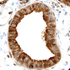 Annexin A4 was detected in immersion fixed paraffin-embedded sections of human kidney using Human/Mouse/Rat Annexin A4 Antigen Affinity-purified Polyclonal Antibody (Catalog # AF4146) at 10 µg/mL overnight at 4 °C. Before incubation with the primary antibody, tissue was subjected to heat-induced epitope retrieval using Antigen Retrieval Reagent-Basic (Catalog # CTS013). Tissue was stained using the Anti-Goat HRP-DAB Cell & Tissue Staining Kit (brown; Catalog # CTS008) and counterstained with hematoxylin (blue). Specific staining was localized to plasma membranes, cytoplasm and nuclei. View our protocol for Chromogenic IHC Staining of Paraffin-embedded Tissue Sections.