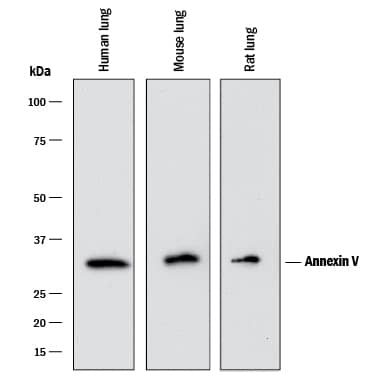 Western blot shows lysates of human lung tissue, mouse lung tissue, and rat lung tissue. PVDF membrane was probed with 1 µg/mL of Goat Anti-Human Annexin V Antigen Affinity-purified Polyclonal Antibody (Catalog # AF399) followed by HRP-conjugated Anti-Goat IgG Secondary Antibody (HAF017). A specific band was detected for Annexin V at approximately 32 kDa (as indicated). This experiment was conducted under reducing conditions and using Immunoblot Buffer Group 1.
