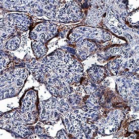 Annexin V was detected in immersion fixed paraffin-embedded sections of human placenta using Mouse Anti-Human Annexin V Monoclonal Antibody (Catalog # MAB3991) at 5 µg/mL for 1 hour at room temperature followed by incubation with the Anti-Mouse IgG VisUCyte™ HRP Polymer Antibody (Catalog # VC001). Tissue was stained using DAB (brown) and counterstained with hematoxylin (blue). Specific staining was localized to syncytiotrophoblasts. View our protocol for IHC Staining with VisUCyte HRP Polymer Detection Reagents.