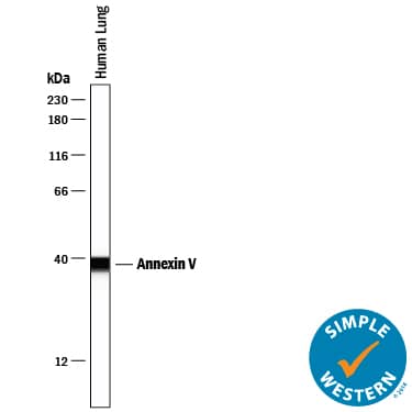 Simple Western lane view shows lysates of human lung tissue, loaded at 0.2 mg/mL. A specific band was detected for Annexin V at approximately 39 kDa (as indicated) using 2.5 µg/mL of Mouse Anti-Human Annexin V Monoclonal Antibody (Catalog # MAB3991). This experiment was conducted under reducing conditions and using the 12-230 kDa separation system.
