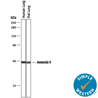 Simple Western lane view shows lysates of human lung tissue and rat lung tissue, loaded at 0.2 mg/mL. A specific band was detected for Annexin V at approximately 39 kDa (as indicated) using 2.5 µg/mL of Mouse Anti-Human/Rat Annexin V Monoclonal Antibody (Catalog # MAB399) . This experiment was conducted under reducing conditions and using the 12-230 kDa separation system.