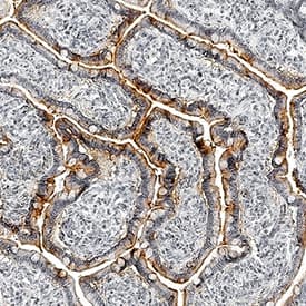 Apolipoprotein A-IV/ApoA4 was detected in immersion fixed paraffin-embedded sections of human small intestine using Sheep Anti-Human/Mouse Apolipoprotein A-IV/ApoA4 Antigen Affinity-purified Polyclonal Antibody (Catalog # AF8125) at 1 µg/mL overnight at 4 °C. Tissue was stained using the Anti-Sheep HRP-DAB Cell & Tissue Staining Kit (brown; Catalog # CTS019) and counterstained with hematoxylin (blue). Specific staining was localized to cell surfaces of epithelial cells. View our protocol for Chromogenic IHC Staining of Paraffin-embedded Tissue Sections.