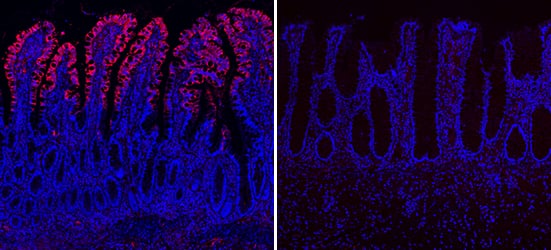 Apolipoprotein A-IV/ApoA4 was detected in immersion fixed paraffin-embedded sections of human ileum (left panel) and descending colon (right panel) using Sheep Anti-Human/Mouse Apolipoprotein A-IV/ApoA4 Antigen Affinity-purified Polyclonal Antibody (Catalog # AF8125) at 0.5 µg/mL overnight at 4 °C. Tissue was stained using the NorthernLights™ 557-conjugated Anti-Sheep IgG Secondary Antibody (red; Catalog # NL010) and counterstained with DAPI (blue).