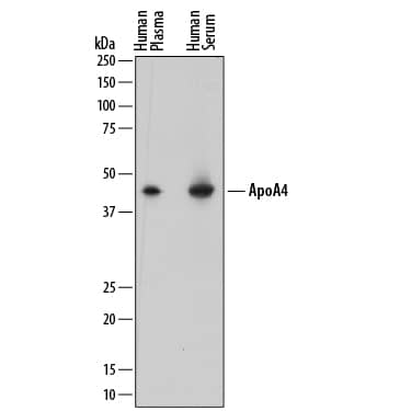 Western blot shows human plasma and human serum. PVDF membrane was probed with 0.2 µg/mL of Sheep Anti-Human/Mouse Apolipoprotein A-IV/ApoA4 Antigen Affinity-purified Polyclonal Antibody (Catalog # AF8125) followed by HRP-conjugated Anti-Sheep IgG Secondary Antibody (Catalog # HAF016). A specific band was detected for Apolipoprotein A-IV/ApoA4 at approximately 45 kDa (as indicated). This experiment was conducted under reducing conditions and using Immunoblot Buffer Group 1.