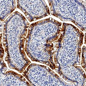 Apolipoprotein A-IV/ApoA4 was detected in immersion fixed paraffin-embedded sections of human intestine using Mouse Anti-Human Apolipoprotein A-IV/ApoA4 Monoclonal Antibody (Catalog # MAB8125) at 5 µg/mL for 1 hour at room temperature followed by incubation with the Anti-Mouse IgG VisUCyte™ HRP Polymer Antibody (Catalog # VC001). Before incubation with the primary antibody, tissue was subjected to heat-induced epitope retrieval using Antigen Retrieval Reagent-Basic (Catalog # CTS013). Tissue was stained using DAB (brown) and counterstained with hematoxylin (blue). Specific staining was localized to cytoplasm in epithelial cells. View our protocol for IHC Staining with VisUCyte HRP Polymer Detection Reagents.