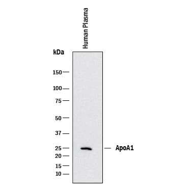 Western blot shows human plasma. PVDF membrane was probed with 0.5 µg/mL of Goat Anti-Human Apolipoprotein A-I/ApoA1 Antigen Affinity-purified Polyclonal Antibody (Catalog # AF3664) followed by HRP-conjugated Anti-Goat IgG Secondary Antibody (Catalog # HAF017). A specific band was detected for Apolipoprotein A-I/ApoA1 at approximately 28 kDa (as indicated). This experiment was conducted under reducing conditions and using Immunoblot Buffer Group 1.