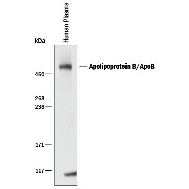 Western Blot Apolipoprotein B/ApoB Antibody [Unconjugated]