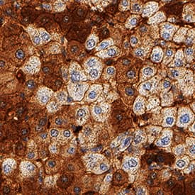 Apolipoprotein B/ApoB was detected in immersion fixed paraffin-embedded sections of human liver using Mouse Anti-Human Apolipoprotein B/ApoB Monoclonal Antibody (Catalog # MAB41241) at 5 µg/mL for 1 hour at room temperature followed by incubation with the Anti-Mouse IgG VisUCyte™ HRP Polymer Antibody (Catalog # VC001). Before incubation with the primary antibody, tissue was subjected to heat-induced epitope retrieval using Antigen Retrieval Reagent-Basic (Catalog # CTS013). Tissue was stained using DAB (brown) and counterstained with hematoxylin (blue). Specific staining was localized to cytoplasm in hepatocytes. View our protocol for IHC Staining with VisUCyte HRP Polymer Detection Reagents.