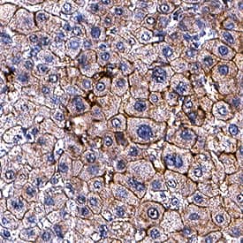 Apolipoprotein B/ApoB was detected in immersion fixed paraffin-embedded sections of human liver using Mouse Anti-Human Apolipoprotein B/ApoB Monoclonal Antibody (Catalog # MAB41242) at 5 µg/mL for 1 hour at room temperature followed by incubation with the Anti-Mouse IgG VisUCyte™ HRP Polymer Antibody (Catalog # VC001). Before incubation with the primary antibody, tissue was subjected to heat-induced epitope retrieval using Antigen Retrieval Reagent-Basic (Catalog # CTS013). Tissue was stained using DAB (brown) and counterstained with hematoxylin (blue). Specific staining was localized to plasma membrane in hepatocytes. View our protocol for IHC Staining with VisUCyte HRP Polymer Detection Reagents.