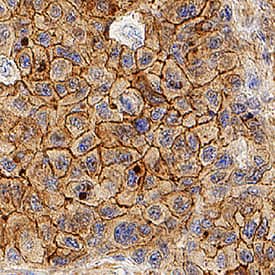 Immunohistochemistry Apolipoprotein B/ApoB Antibody (369717) [Unconjugated]