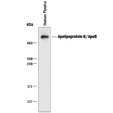 Western Blot Apolipoprotein B/ApoB Antibody (369717) [Unconjugated]