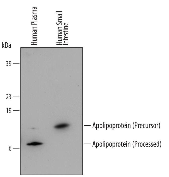 Western blot shows lysates of human plasma and small intestine tissue. PVDF membrane was probed with 0.25 µg/mL of Human Apolipoprotein C-II/ApoC2 Biotinylated Antigen Affinity-purified Polyclonal Antibody (Catalog # BAF4497) followed by HRP-conjugated Anti-Sheep IgG Secondary Antibody (Catalog # HAF016). A specific band was detected for Apolipoprotein C-II/ApoC2 at approximately 8 kDa (as indicated). This experiment was conducted under reducing conditions and using Immunoblot Buffer Group 2.