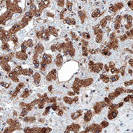 Apolipoprotein C-II/ApoC2 was detected in immersion fixed paraffin-embedded sections of human liver using Rabbit Anti-Human Apolipoprotein C-II/ApoC2 Monoclonal Antibody (Catalog # MAB4497) at 0.3 µg/mL for 1 hour at room temperature followed by incubation with the Anti-Rabbit IgG VisUCyte™ HRP Polymer Antibody (Catalog # VC003). Before incubation with the primary antibody, tissue was subjected to heat-induced epitope retrieval using Antigen Retrieval Reagent-Basic (Catalog # CTS013). Tissue was stained using DAB (brown) and counterstained with hematoxylin (blue). Specific staining was localized to cytoplasm in hepatocytes. View our protocol for IHC Staining with VisUCyte HRP Polymer Detection Reagents.