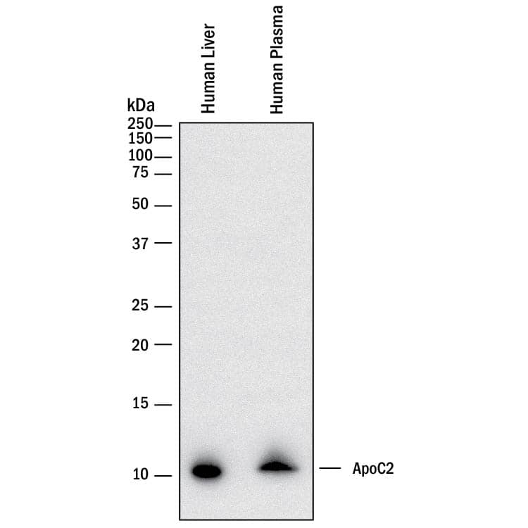 Western blot shows lysates of human liver tissue and human plasma. PVDF membrane was probed with 0.5 µg/mL of Rabbit Anti-Human Apolipoprotein C-II/ApoC2 Monoclonal Antibody (Catalog # MAB4497) followed by HRP-conjugated Anti-Rabbit IgG Secondary Antibody (Catalog # HAF008). A specific band was detected for Apolipoprotein C-II/ApoC2 at approximately 11 kDa (as indicated). This experiment was conducted under reducing conditions and using Immunoblot Buffer Group 1.