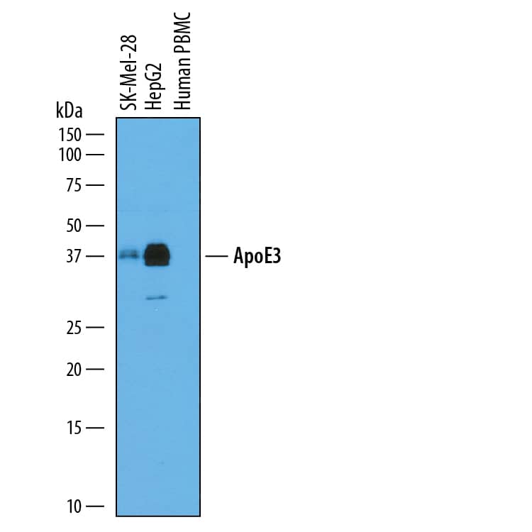 Western blot shows conditioned media from SK-Mel-28 human malignant melanoma cell line, HepG2 human hepatocellular carcinoma cell line, and human peripheral blood mononuclear cells (PBMC). PVDF membrane was probed with 0.5 µg/mL of Goat Anti-Human Apolipoprotein E/ApoE Antigen Affinity-purified Polyclonal Antibody (Catalog # AF4144) followed by HRP-conjugated Anti-Goat IgG Secondary Antibody (Catalog # HAF109). A specific band was detected for Apolipoprotein E/ApoE at approximately 38 kDa (as indicated). This experiment was conducted under reducing conditions and using Immunoblot Buffer Group 1.
