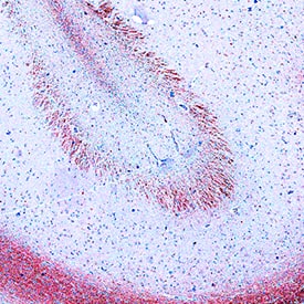 Apolipoprotein E/ApoE was detected in immersion fixed paraffin-embedded sections of human brain (hippocampus) using Mouse Anti-Human Apolipoprotein E/ApoE Monoclonal Antibody (Catalog # MAB41443) at 5 µg/mL for 1 hour at room temperature followed by incubation with the Anti-Mouse IgG VisUCyte™ HRP Polymer Antibody (VC001). Tissue was stained using DAB (brown) and counterstained with hematoxylin (blue). Specific staining was localized to cytoplasm. View our protocol for IHC Staining with VisUCyte HRP Polymer Detection Reagents.