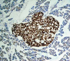 Immunohistochemistry Apolipoprotein H/ApoH Antibody [Unconjugated]