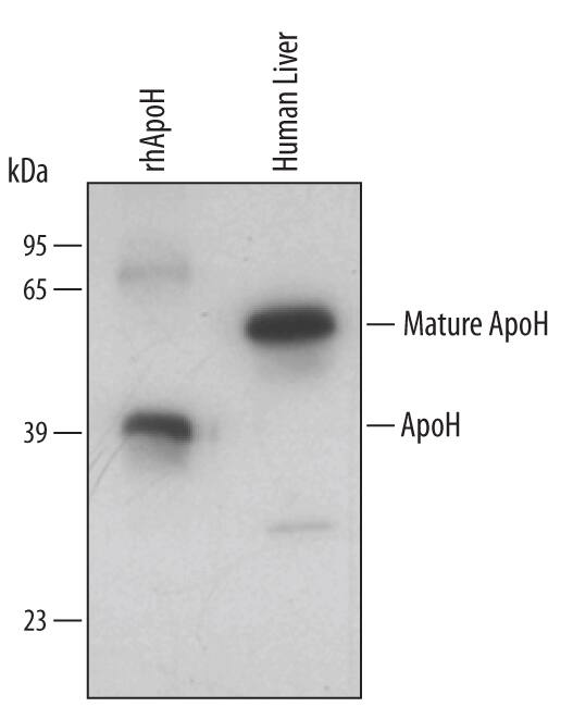 Western Blot Apolipoprotein H/ApoH Antibody [Unconjugated]