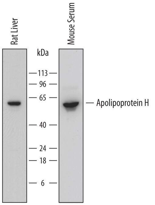 Western blot shows lysates of rat liver tissue and mouse serum. PVDF membrane was probed with 0.25 µg/mL of Sheep Anti-Mouse/Rat Apolipoprotein H/ApoH Antigen Affinity-purified Polyclonal Antibody (Catalog # AF6575) followed by HRP-conjugated Anti-Sheep IgG Secondary Antibody (Catalog # HAF016). A specific band was detected for Apolipoprotein H/ApoH at approximately 50-60 kDa (as indicated). This experiment was conducted under reducing conditions and using Immunoblot Buffer Group 1.