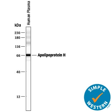 Simple Western lane view shows human plasma, loaded at 0.2 mg/mL. A specific band was detected for Apolipoprotein H/ApoH at approximately 67 kDa (as indicated) using 10 µg/mL of Mouse Anti-Human Apolipoprotein H/ApoH Monoclonal Antibody (Catalog # MAB5087) . This experiment was conducted under reducing conditions and using the 12-230 kDa separation system.