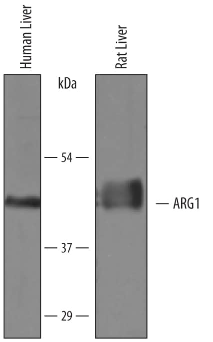 Western blot shows lysates of human liver tissue and rat liver tissue. PVDF membrane was probed with 0.25 µg/mL of Sheep Anti-Human/Mouse/Rat Arginase 1/ARG1 Antigen Affinity-purified Polyclonal Antibody (Catalog # AF5868) followed by HRP-conjugated Anti-Sheep IgG Secondary Antibody (Catalog # HAF016). A specific band was detected for Arginase 1/ARG1 at approximately 41 kDa (as indicated). This experiment was conducted under reducing conditions and using Immunoblot Buffer Group 8.