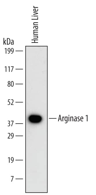Western blot shows lysates of human liver tissue. PVDF Membrane was probed with 1 µg/mL of Human Arginase 1/ARG1 Monoclonal Antibody (Catalog # MAB5868) followed by HRP-conjugated Anti-Mouse IgG Secondary Antibody (Catalog # HAF007). A specific band was detected for Arginase 1/ARG1 at approximately 40 kDa (as indicated). This experiment was conducted under reducing conditions and using Immunoblot Buffer Group 1.
