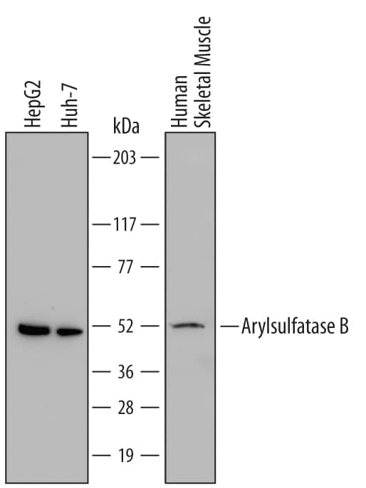 Western Blot Arylsulfatase B/ARSB Antibody [Unconjugated]