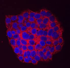 Immunocytochemistry Arylsulfatase B/ARSB Antibody (708401)