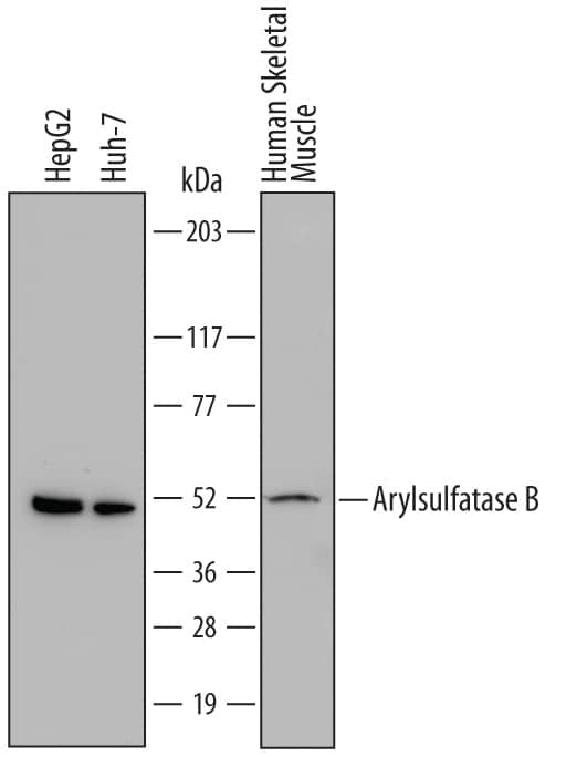 Western Blot Arylsulfatase B/ARSB Antibody (708401)