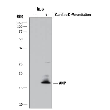 Western blot shows lysates of iBJ6 human induced pluripotent stem cell line untreated (-) or differentiated to cardiomyoctyes (+). PVDF membrane was probed with 1 µg/mL of Goat Anti-Human Atrial Natriuretic Peptide/ANP Antigen Affinity-purified Polyclonal Antibody (Catalog # AF3366) followed by HRP-conjugated Anti-Goat IgG Secondary Antibody (Catalog # HAF017). A specific band was detected for Atrial Natriuretic Peptide/ANP at approximately 17 kDa (as indicated). This experiment was conducted under reducing conditions and using Immunoblot Buffer Group 1.