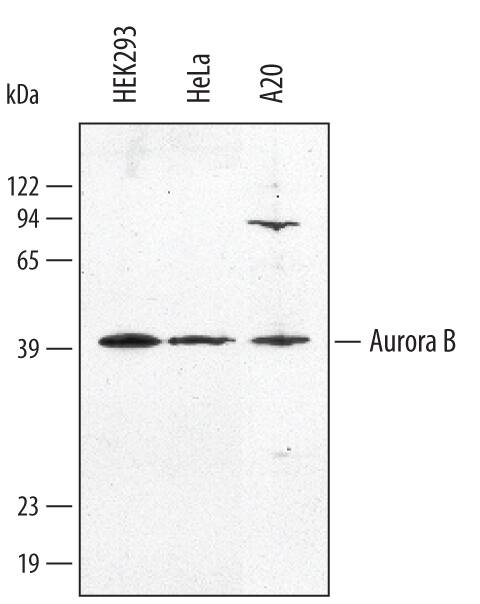 Western blot shows lysates of HEK293 human embryonic kidney cell line, HeLa human cervical epithelial carcinoma cell line, and A20 mouse B cell lymphoma cell line. PVDF membrane was probed with 1 µg/mL of Human Aurora B Antigen Affinity-purified Polyclonal Antibody (Catalog # AF4006) followed by HRP-conjugated Anti-Goat IgG Secondary Antibody (Catalog # HAF017). A specific band was detected for Aurora B at approximately 40 kDa (as indicated). This experiment was conducted using Immunoblot Buffer Group 1.