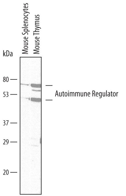 Western Blot Autoimmune Regulator/AIRE Antibody (609930) [Unconjugated]