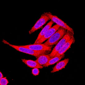 Axin-2 was detected in immersion fixed SW480 human colorectal adenocarcinoma cell line using Mouse Anti-Human Axin-2 Monoclonal Antibody (Catalog # MAB6078) at 10 µg/mL for 3 hours at room temperature. Cells were stained using the NorthernLights™ 557-conjugated Anti-Mouse IgG Secondary Antibody (red; Catalog # NL007) and counterstained with DAPI (blue). Specific staining was localized to cytoplasm. View our protocol for Fluorescent ICC Staining of Cells on Coverslips.
