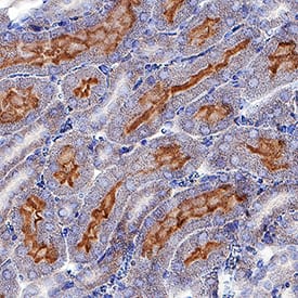 Immunohistochemistry Axl Antibody [Unconjugated]