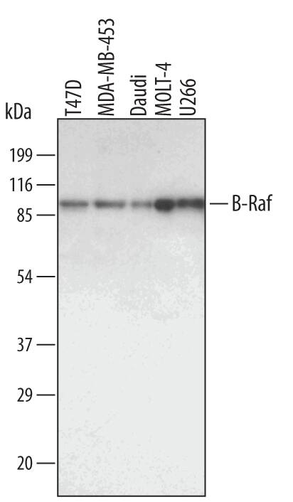 Western blot shows lysates of T47D human breast cancer cell line, MDA-MB-453 human breast cancer cell line, Daudi human Burkitt's lymphoma cell line, MOLT-4 human acute lymphoblastic leukemia cell line and U266 human myeloma cell line. PVDF membrane was probed with 1 µg/mL of Goat Anti-Human B-Raf Antigen Affinity-purified Polyclonal Antibody (Catalog # AF3424) followed by HRP-conjugated Anti-Goat IgG Secondary Antibody (Catalog # HAF109). A specific band was detected for B-Raf at approximately 95 kDa (as indicated). This experiment was conducted under reducing conditions and using Immunoblot Buffer Group 1.