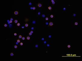 B220/CD45R was detected in immersion fixed mouse splenocytes using Mouse B220/CD45R Biotinylated Monoclonal Antibody (Catalog # BAM1217) at 10 µg/mL for 3 hours at room temperature. Cells were stained using the NorthernLights™ 557-conjugated Streptavidin (yellow; Catalog # NL999) and counterstained with DAPI (blue). View our protocol for Fluorescent ICC Staining of Non-adherent Cells.