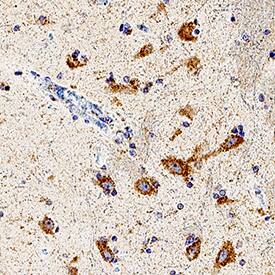 Immunohistochemistry beta-1,3-Glucuronyltransferase 1/B3GAT1 Antibody (1021209) [Unconjugated]