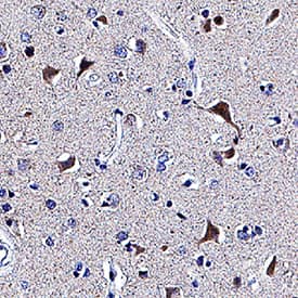  beta -1,3-Glucuronyltransferase 1/B3GAT1 was detected in immersion fixed paraffin-embedded sections of human brain (cortex) using Mouse Anti-Human  beta -1,3-Glucuronyltransferase 1/B3GAT1 Monoclonal Antibody (Catalog # MAB8560) at 5 µg/mL for 1 hour at room temperature followed by incubation with the Anti-Mouse IgG VisUCyte™ HRP Polymer Antibody (Catalog # VC001). Before incubation with the primary antibody, tissue was subjected to heat-induced epitope retrieval using Antigen Retrieval Reagent-Basic (Catalog # CTS013). Tissue was stained using DAB (brown) and counterstained with hematoxylin (blue). Specific staining was localized to cytoplasm in neurons. View our protocol for IHC Staining with VisUCyte HRP Polymer Detection Reagents.