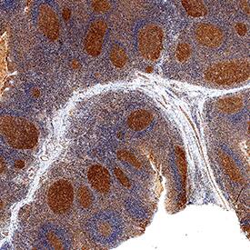 B7-1/CD80 was detected in immersion fixed paraffin-embedded sections of human tonsil using Goat Anti-Human B7-1/CD80 Antigen Affinity-purified Polyclonal Antibody (Catalog # AF140) at 3 µg/mL overnight at 4 °C. Tissue was stained using the Anti-Goat HRP-DAB Cell & Tissue Staining Kit (brown; Catalog # CTS008) and counterstained with hematoxylin (blue). Specific staining was localized to lymphocytes in germinal center. View our protocol for Chromogenic IHC Staining of Paraffin-embedded Tissue Sections.