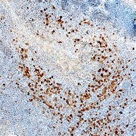 B7-1/CD80 was detected in immersion fixed paraffin-embedded sections of human tonsil using Mouse Anti-Human B7-1/CD80 Monoclonal Antibody (Catalog # MAB140) at 5 µg/mL overnight at 4 °C. Tissue was stained using the Anti-Mouse HRP-DAB Cell & Tissue Staining Kit (brown; Catalog # CTS002) and counterstained with hematoxylin (blue). Specific staining was localized to cytoplasm in lymphocytes. View our protocol for Chromogenic IHC Staining of Paraffin-embedded Tissue Sections.