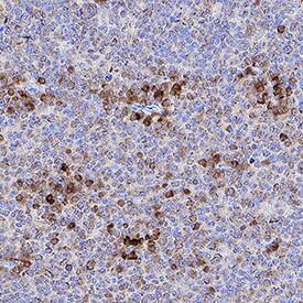 B7-1/CD80 was detected in immersion fixed paraffin-embedded sections of human tonsil using Rat Anti-Mouse B7-1/CD80 Monoclonal Antibody (Catalog # MAB740) at 5 µg/mL overnight at 4 °C. Tissue was stained using the Anti-Rat HRP-DAB Cell & Tissue Staining Kit (brown; CTS017) and counterstained with hematoxylin (blue). Specific staining was localized to lymphocyte cytoplasm. View our protocol for Chromogenic IHC Staining of Paraffin-embedded Tissue Sections.