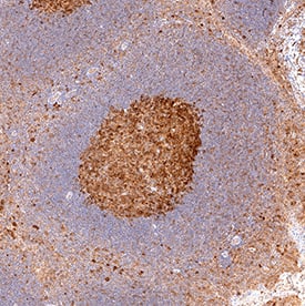 B7-2/CD86 was detected in immersion fixed paraffin-embedded sections of human tonsil using Goat Anti-Human B7-2/CD86 Antigen Affinity-purified Polyclonal Antibody (Catalog # AF-141-NA) at 3 µg/mL for 1 hour at room temperature followed by incubation with the Anti-Goat IgG VisUCyte™ HRP Polymer Antibody (Catalog # VC004). Tissue was stained using DAB (brown) and counterstained with hematoxylin (blue). Specific staining was localized to lymphocytes. View our protocol for IHC Staining with VisUCyte HRP Polymer Detection Reagents.