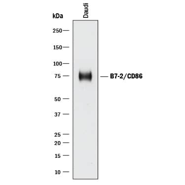 Western blot shows lysates of Daudi human Burkitt's lymphoma cell line. PVDF membrane was probed with 5 µg/mL of Mouse Anti-Human B7-2/CD86 Monoclonal Antibody (Catalog # MAB141) followed by HRP-conjugated Anti-Mouse IgG Secondary Antibody (Catalog # HAF018). A specific band was detected for B7-2/CD86 at approximately 75 kDa (as indicated). This experiment was conducted under reducing conditions and using Immunoblot Buffer Group 1.
