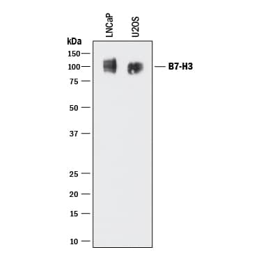 Western Blot B7-H3/CD276 Antibody (185504) [Unconjugated]