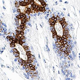 B7-H4 was detected in immersion fixed paraffin-embedded sections of human breast using Mouse Anti-Human B7-H4 Monoclonal Antibody (Catalog # MAB65761) at 1.7 µg/mL for 1 hour at room temperature followed by incubation with the Anti-Mouse IgG VisUCyte™ HRP Polymer Antibody (Catalog # VC001). Tissue was stained using DAB (brown) and counterstained with hematoxylin (blue). Specific staining was localized to plasma membrane in epithelial cells. View our protocol for IHC Staining with VisUCyte HRP Polymer Detection Reagents.