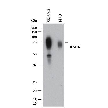 Western blot shows lysates of SK-BR-3 human breast cancer cell line and T47D human breast cancer cell line. PVDF membrane was probed with 1 µg/mL of Rabbit Anti-Human B7-H4 Monoclonal Antibody (Catalog # MAB65764) followed by HRP-conjugated Anti-Rabbit IgG Secondary Antibody (Catalog # HAF008). A specific band was detected for B7-H4 at approximately 50-80 kDa (as indicated). This experiment was conducted under reducing conditions and using Immunoblot Buffer Group 1.